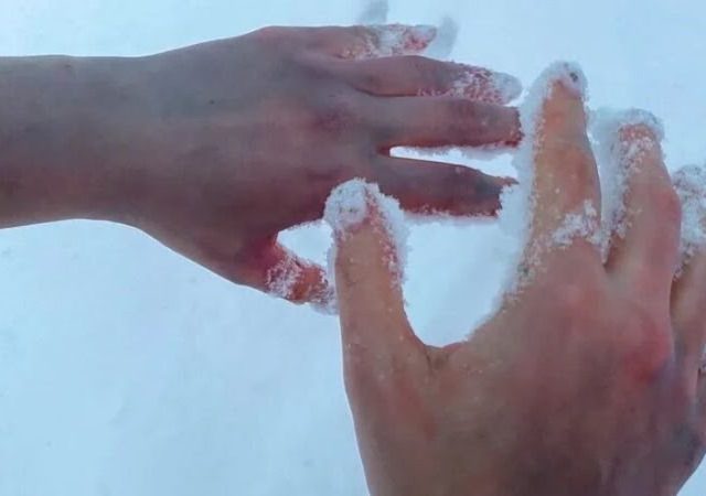 У калоніях Магілёўшчыны вязні абмарожваюць рукі, а перадаваць ім крэмы забаранілі